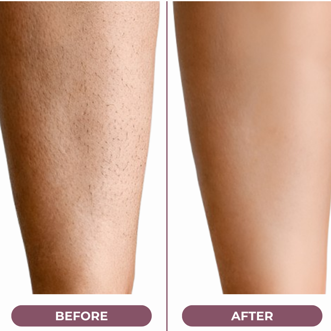 Minicost™ Velvety