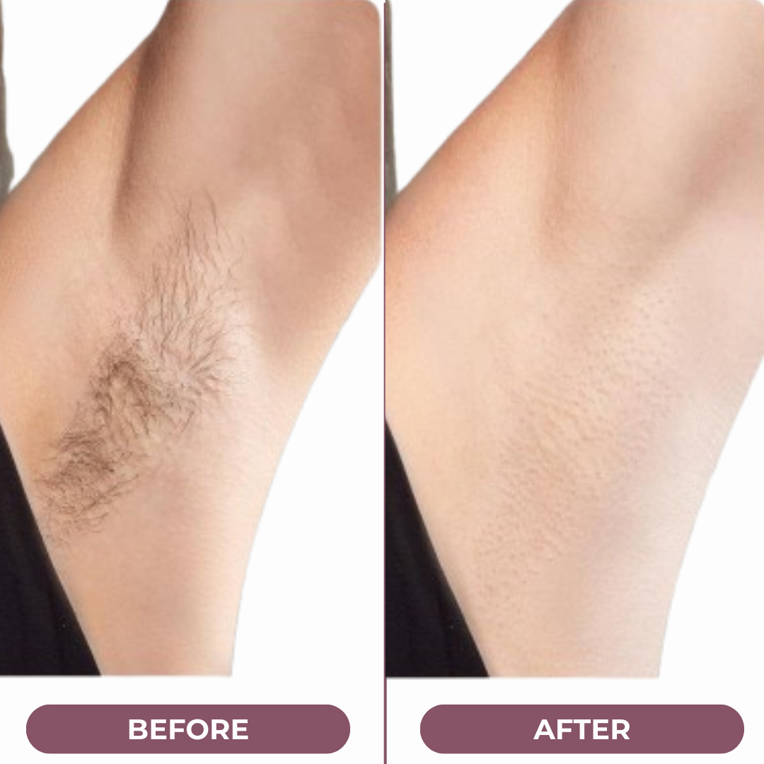 Minicost™ Velvety